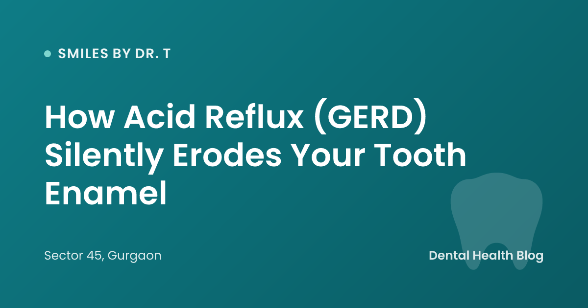 How Acid Reflux (GERD) Silently Erodes Your Tooth Enamel