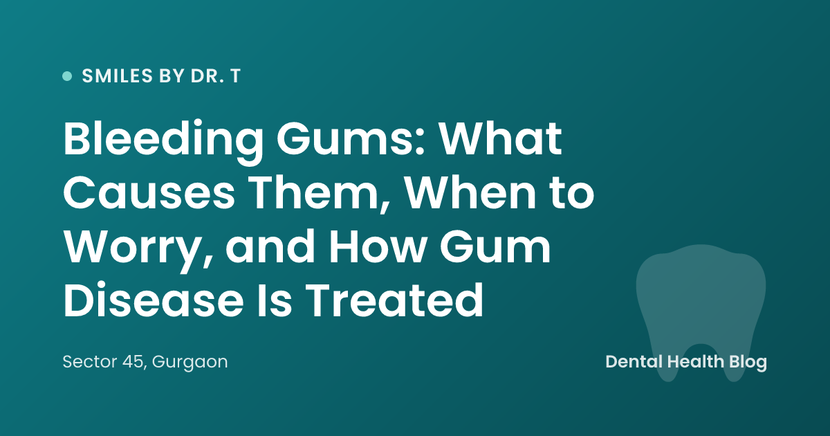 Bleeding Gums: What Causes Them, When to Worry, and How Gum Disease Is Treated