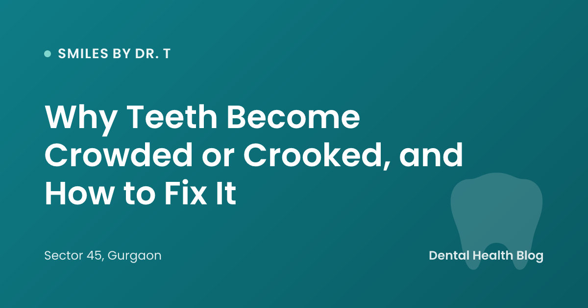Why Teeth Become Crowded or Crooked, and How to Fix It
