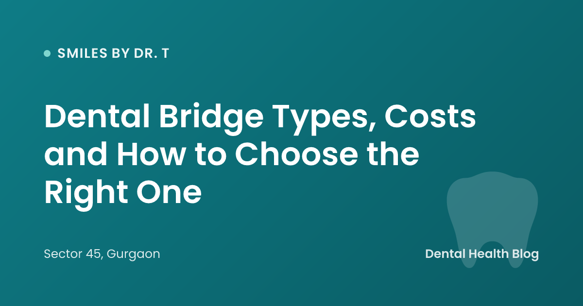 Dental Bridge Types, Costs and How to Choose the Right One