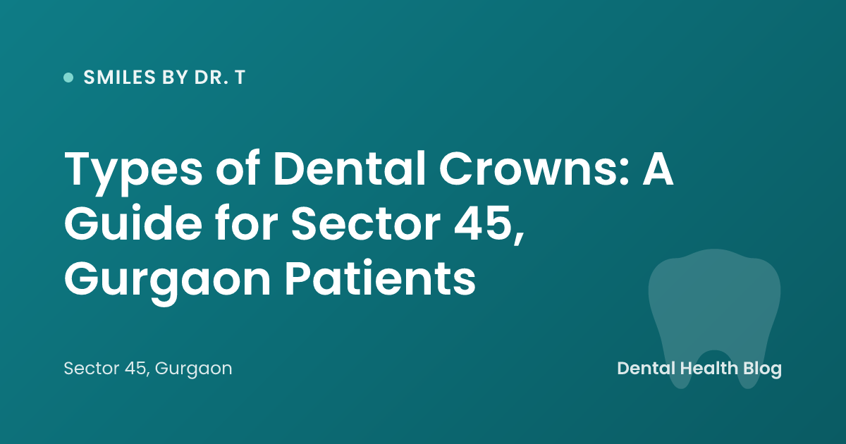 Types of Dental Crowns: A Guide for Sector 45, Gurgaon Patients