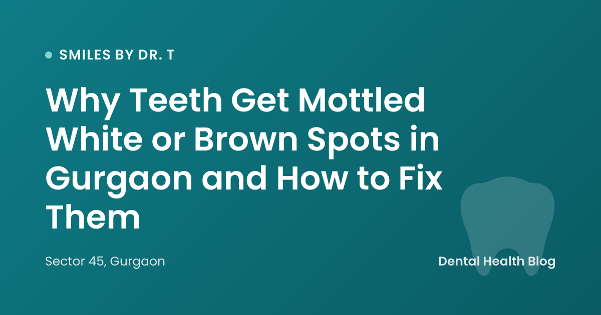 Why Teeth Get Mottled White or Brown Spots in Gurgaon and How to Fix Them