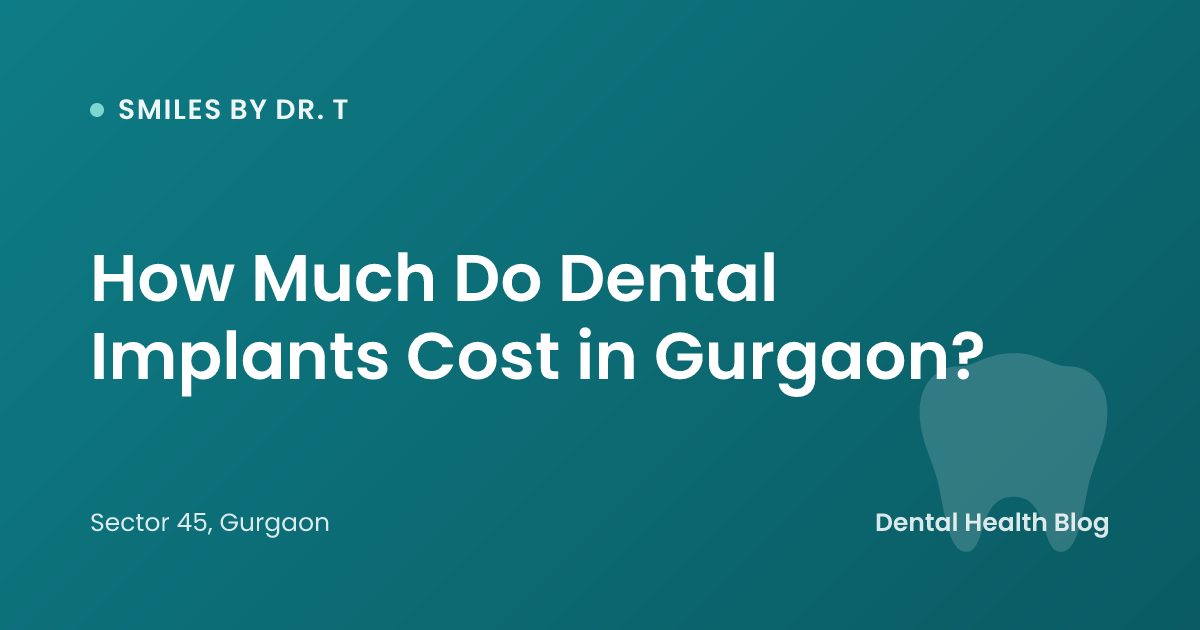 How Much Do Dental Implants Cost in Gurgaon?