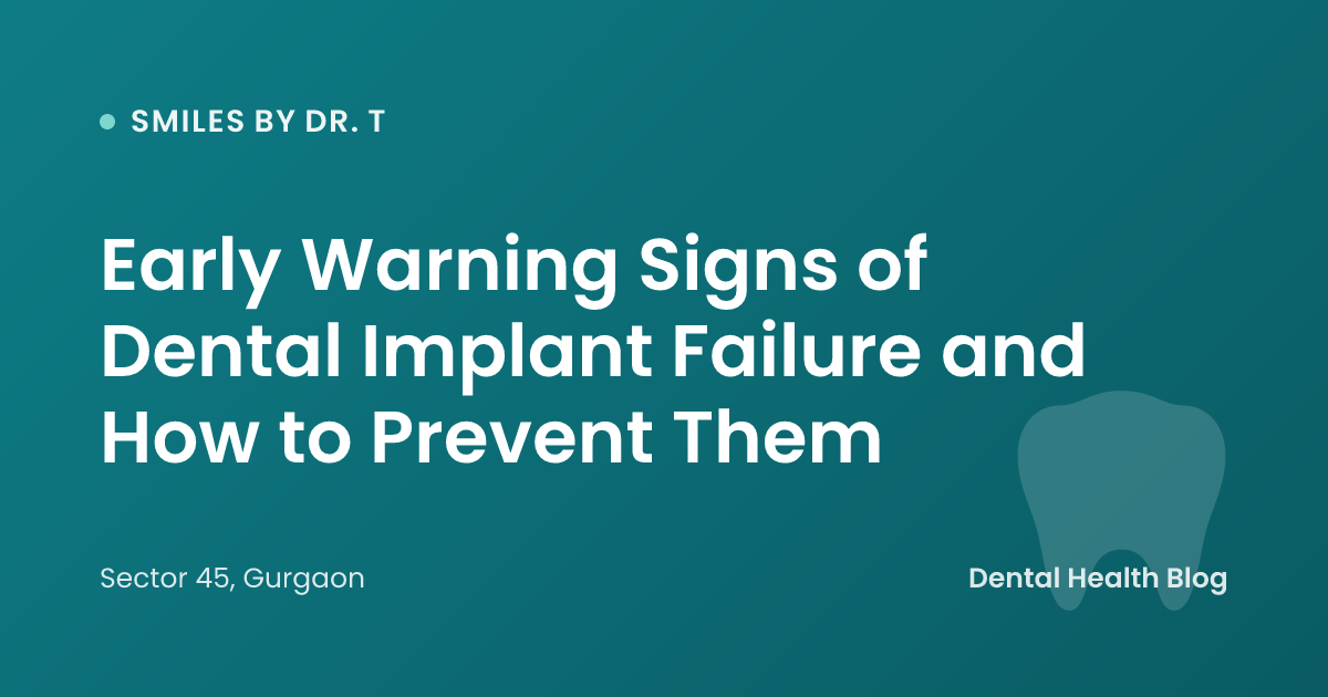 Early Warning Signs of Dental Implant Failure and How to Prevent Them