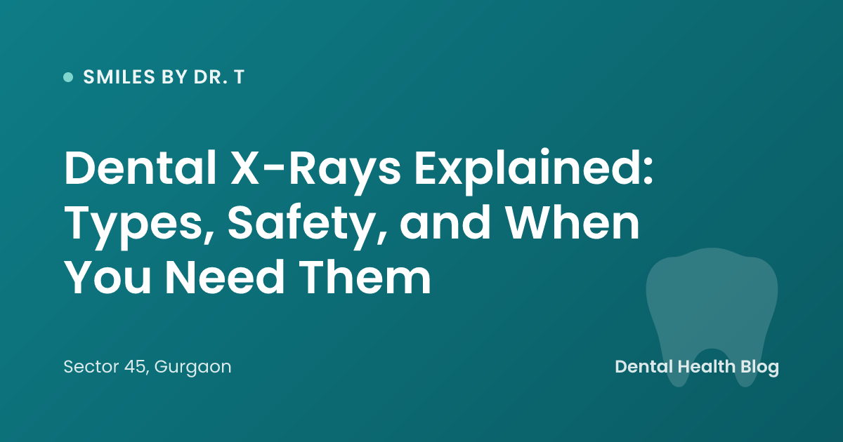 Dental X-Rays Explained: Types, Safety, and When You Need Them