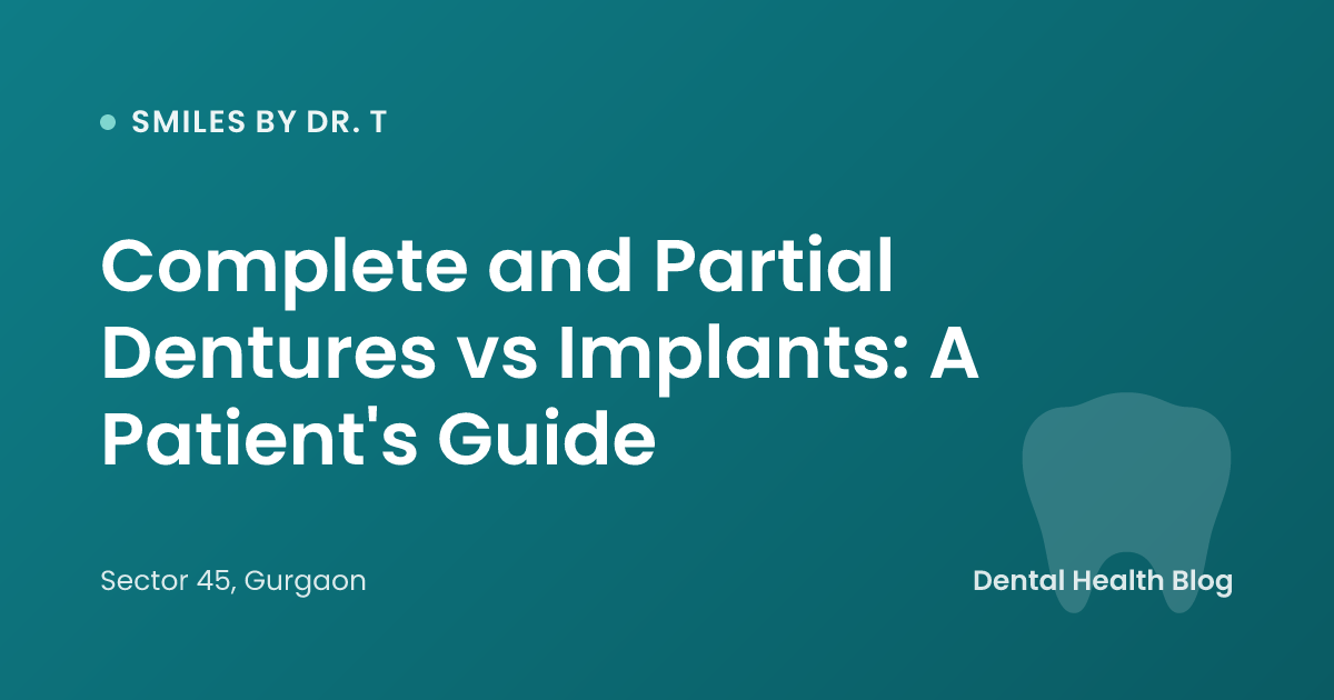 Complete and Partial Dentures vs Implants: A Patient's Guide
