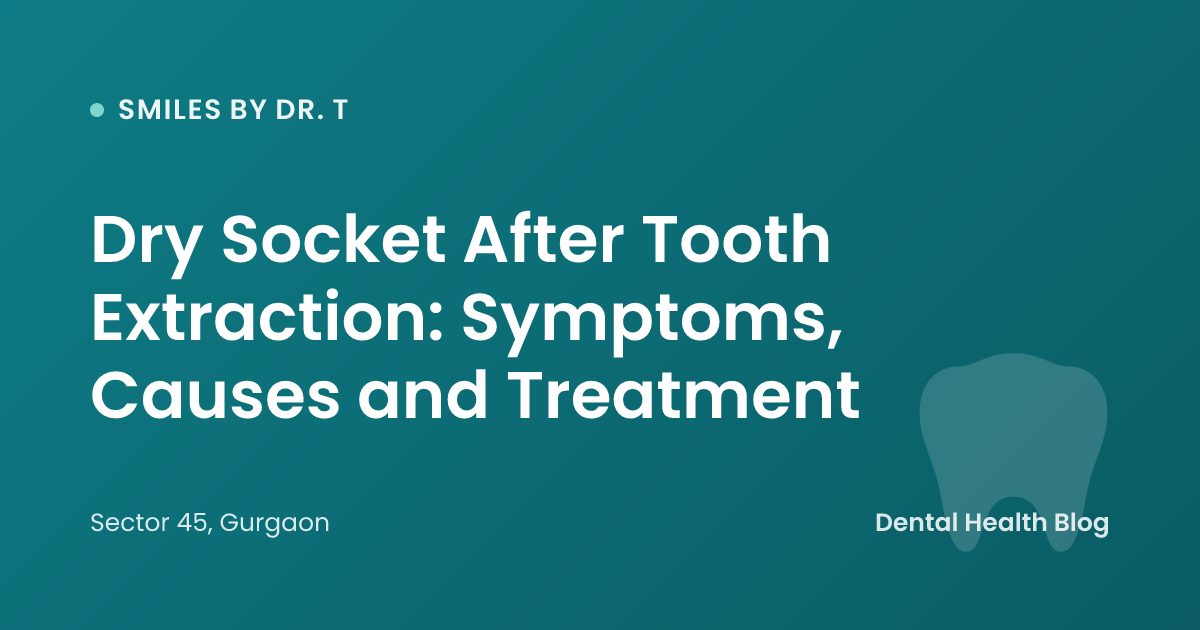Dry Socket After Tooth Extraction: Symptoms, Causes and Treatment