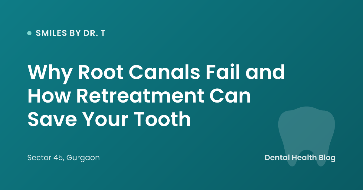 Why Root Canals Fail and How Retreatment Can Save Your Tooth