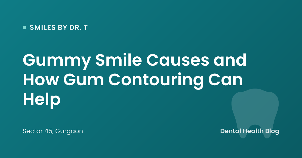 Gummy Smile Causes and How Gum Contouring Can Help
