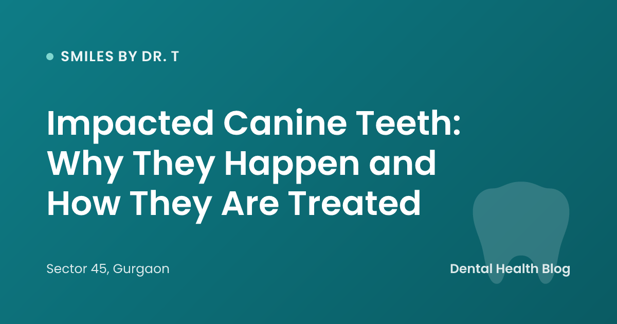 Impacted Canine Teeth: Why They Happen and How They Are Treated