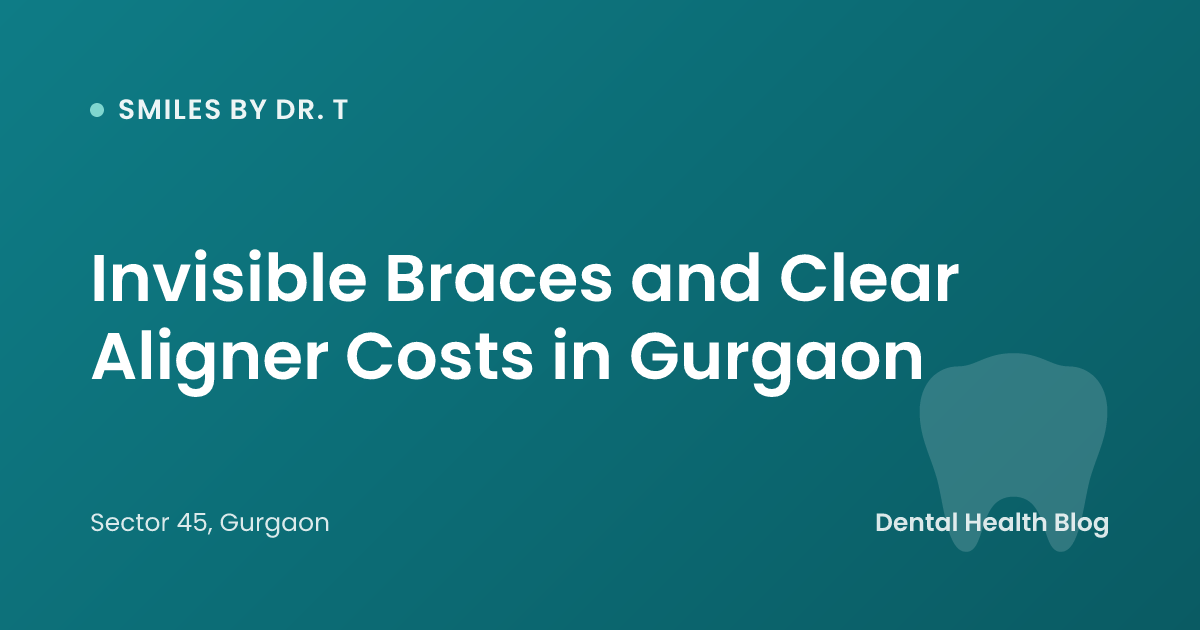 Invisible Braces and Clear Aligner Costs in Gurgaon