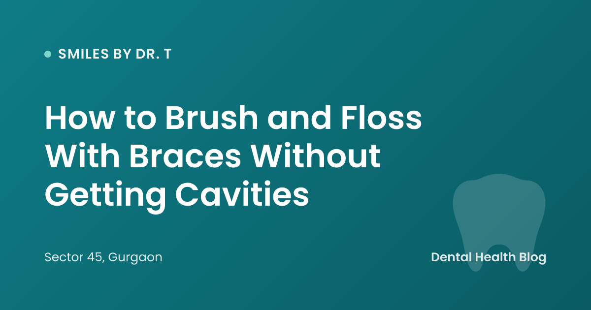 How to Brush and Floss With Braces Without Getting Cavities