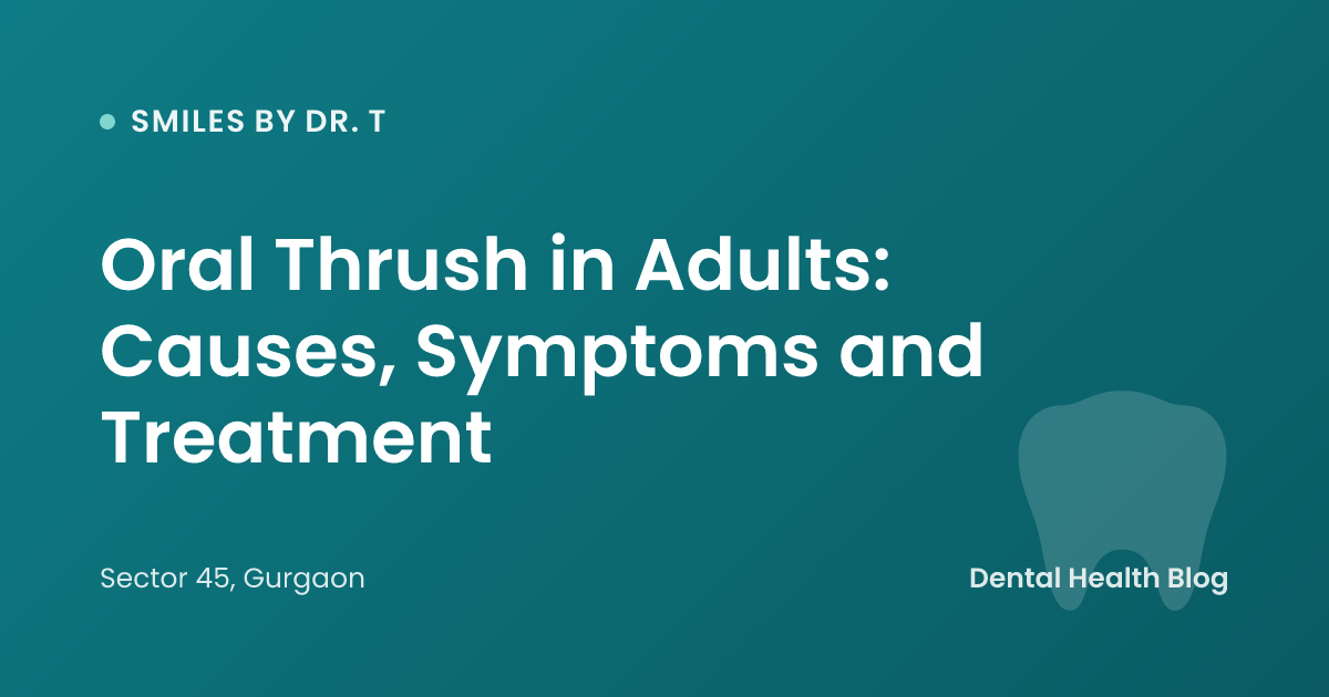 Oral Thrush in Adults: Causes, Symptoms and Treatment