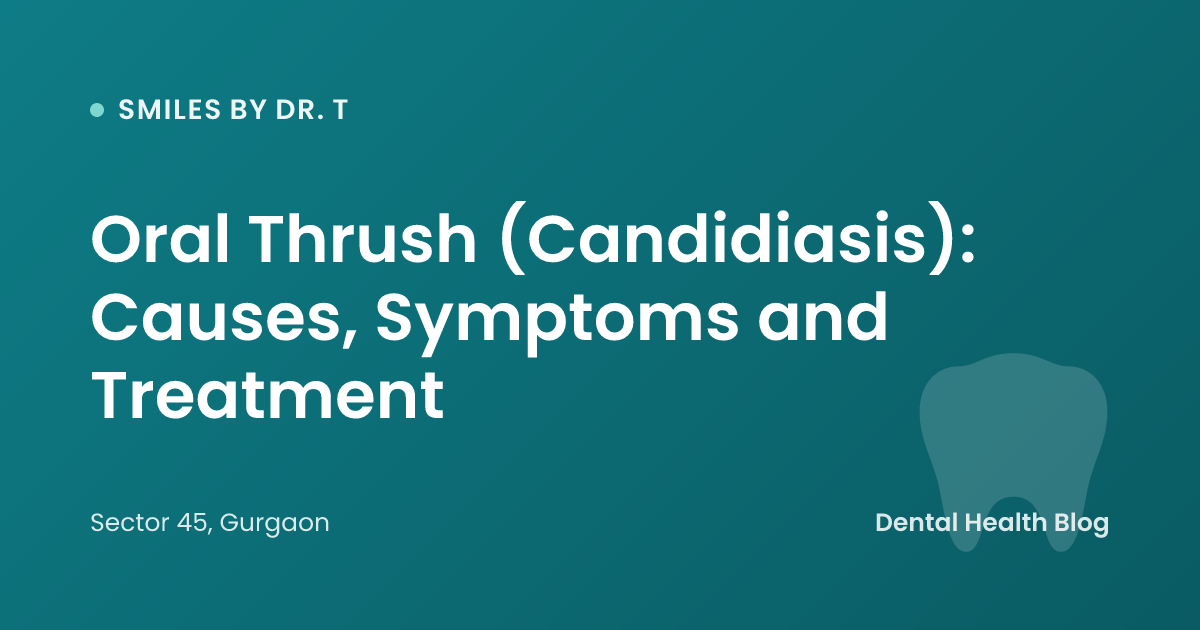 Oral Thrush (Candidiasis): Causes, Symptoms and Treatment