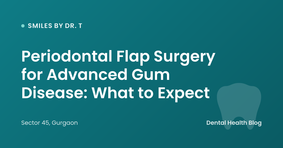 Periodontal Flap Surgery for Advanced Gum Disease: What to Expect