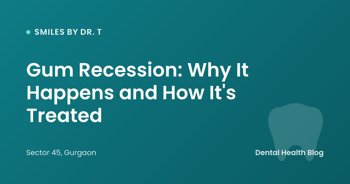 Gum Recession: Why It Happens and How It's Treated