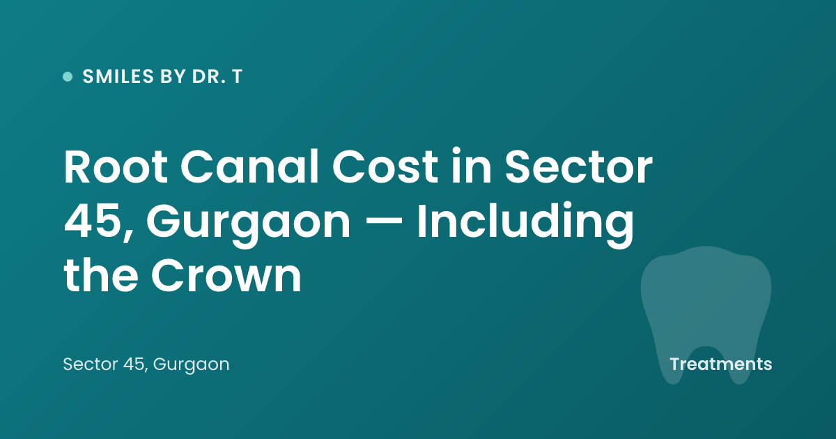 Root Canal Cost in Sector 45, Gurgaon — Including the Crown