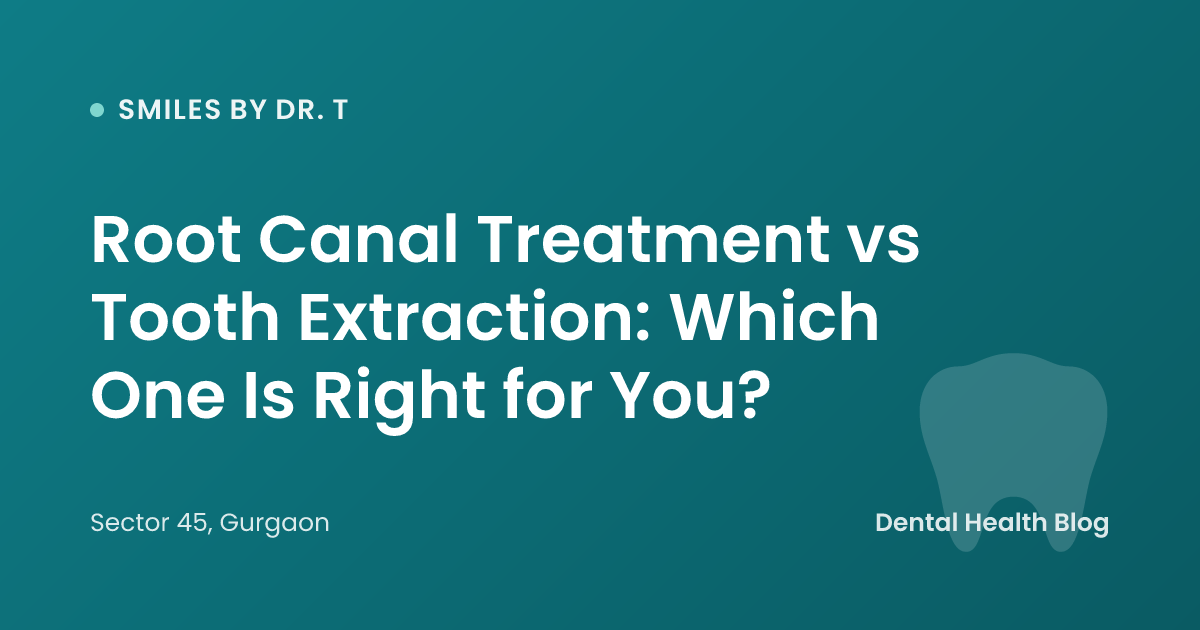 Root Canal Treatment vs Tooth Extraction: Which One Is Right for You?