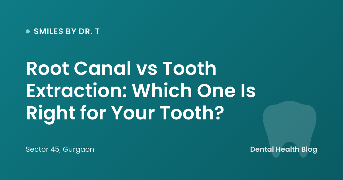 Root Canal vs Tooth Extraction: Which One Is Right for Your Tooth?