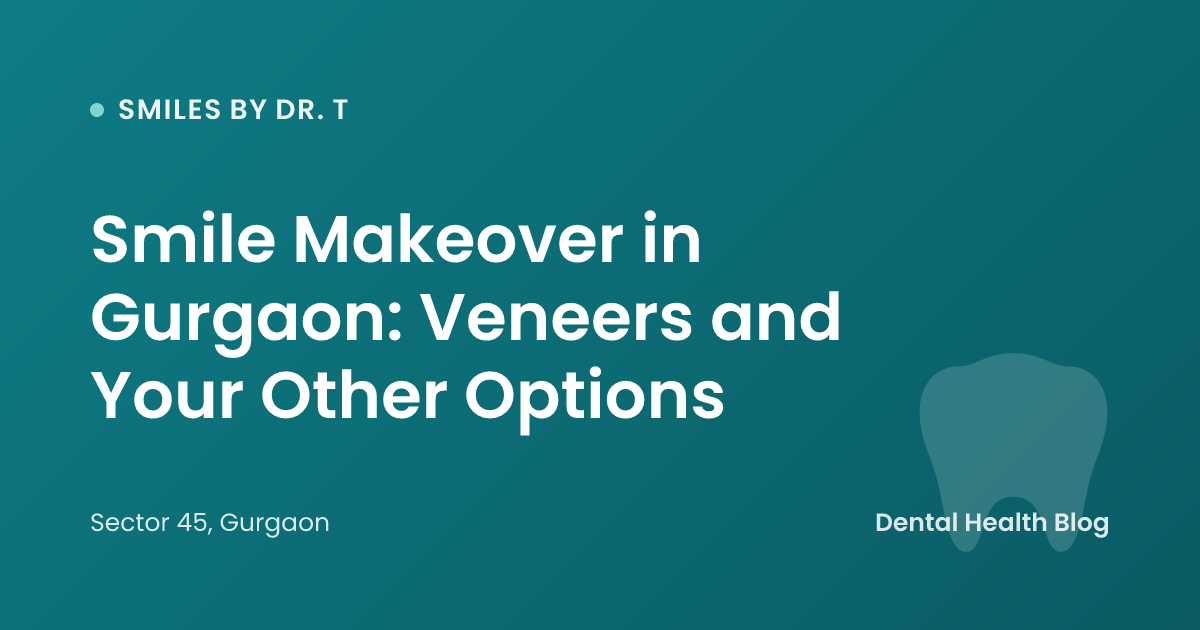 Smile Makeover in Gurgaon: Veneers and Your Other Options