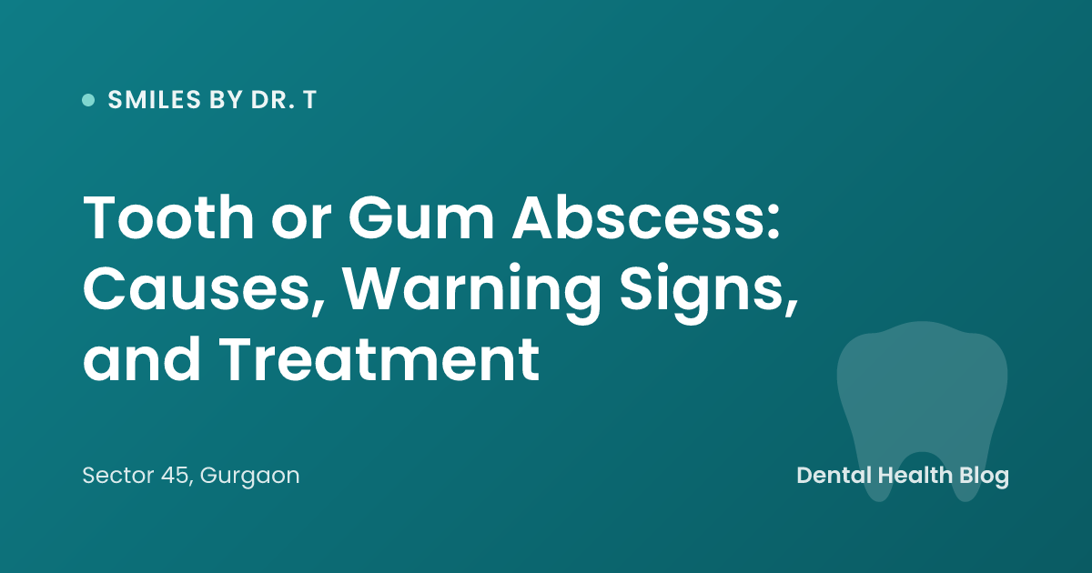 Tooth or Gum Abscess: Causes, Warning Signs, and Treatment