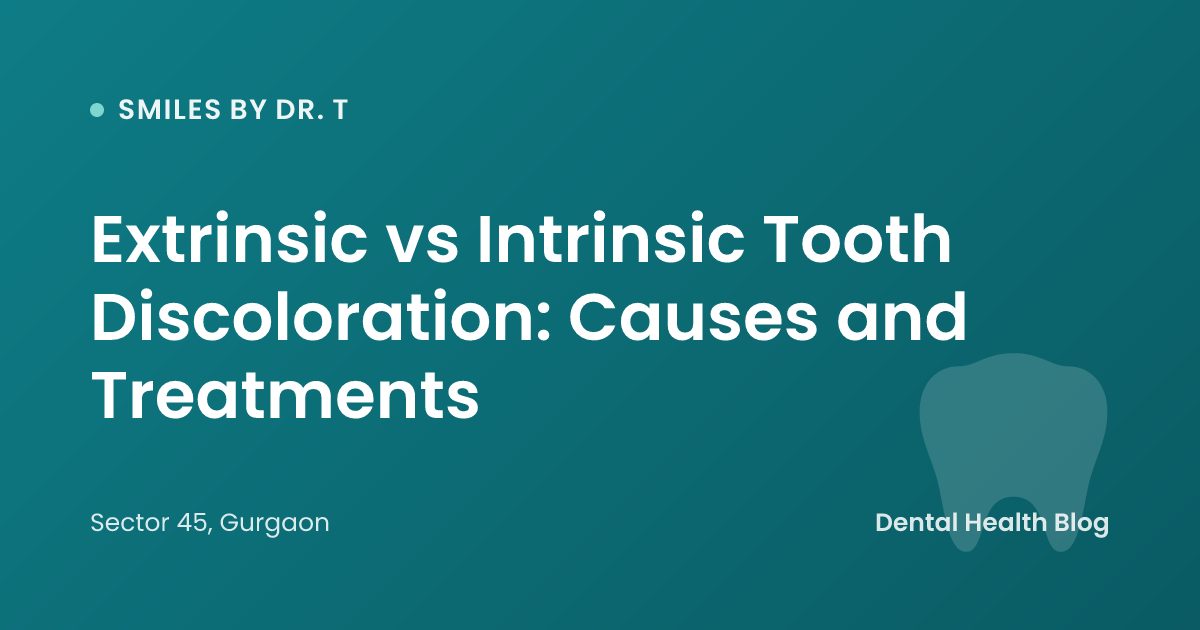 Extrinsic vs Intrinsic Tooth Discoloration: Causes and Treatments