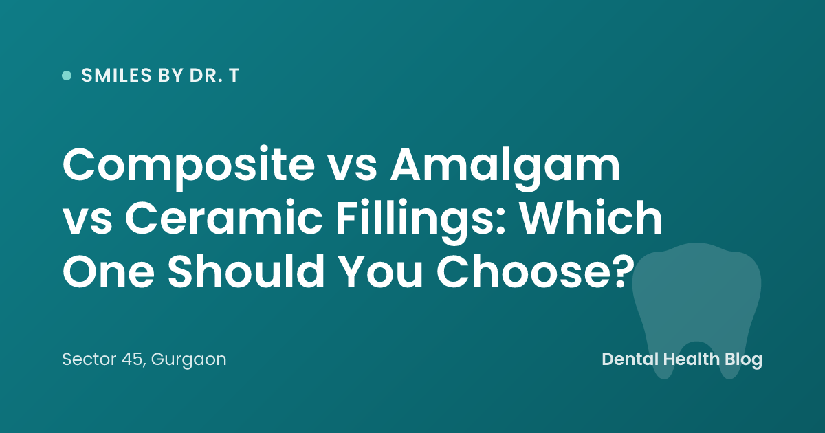 Composite vs Amalgam vs Ceramic Fillings: Which One Should You Choose?