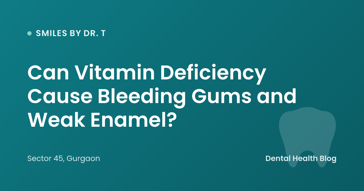 Can Vitamin Deficiency Cause Bleeding Gums and Weak Enamel?